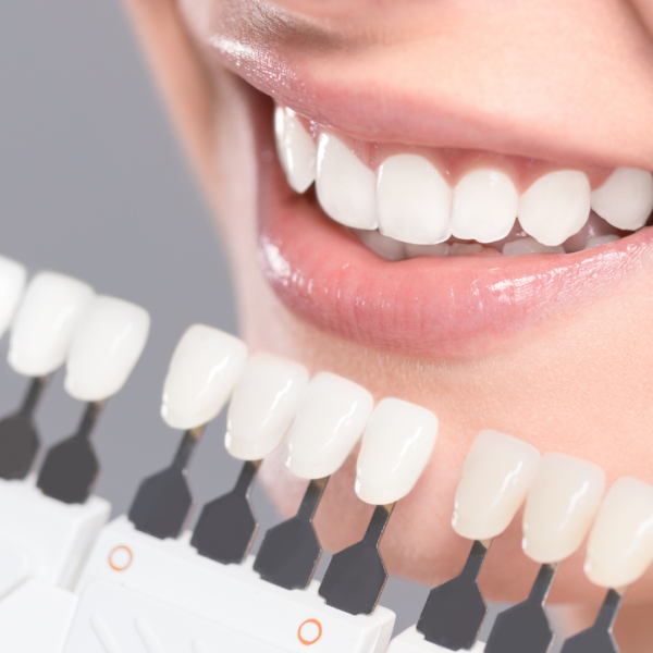 iLED Teeth Whitening Light - Image 6