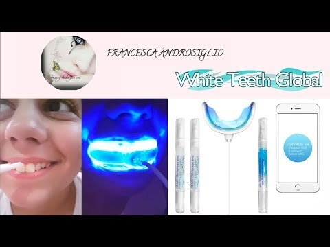 WTG iLED Whitening Kit review by francesca androsiglio