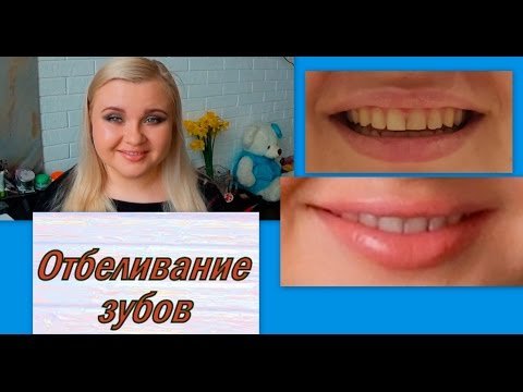 WTG Basic Whitening Kit review by Elle Vezel [RUS]